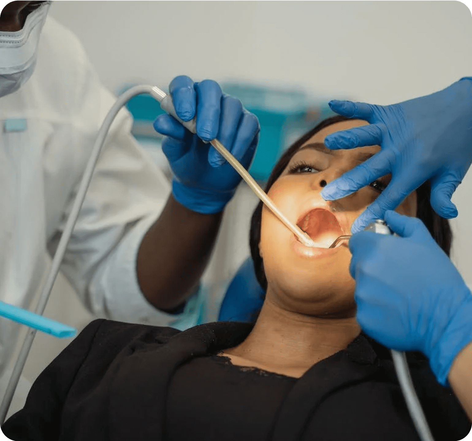 Teeth Whitening Treatment Aftercare