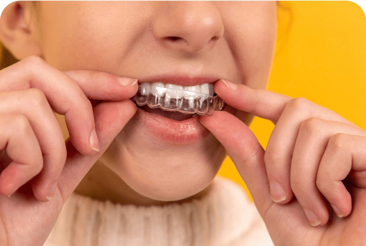  Achieving a dazzling smile: the power of professional teeth whitening